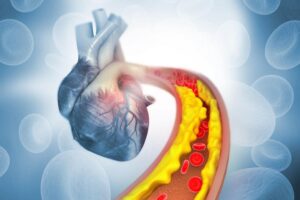 4238879_674f7908895ec03