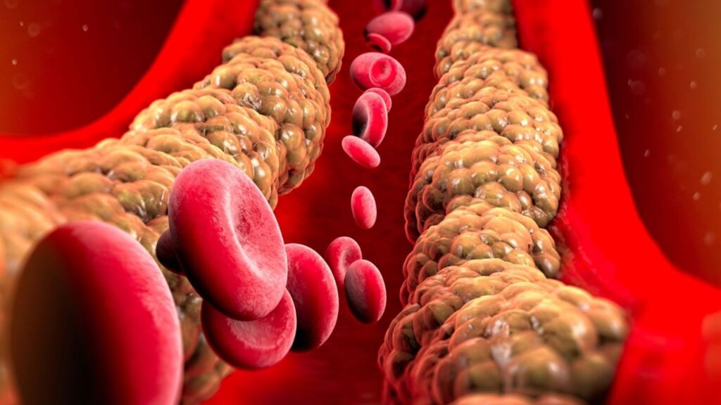 xr:d:DAE-o2w-RNw:396,j:1567646180723632915,t:23061513