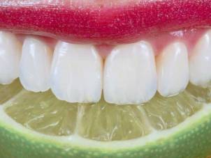 erosao-dentaria_site