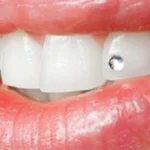 800_crop_5fdf893091193_5fdf8925bcc97